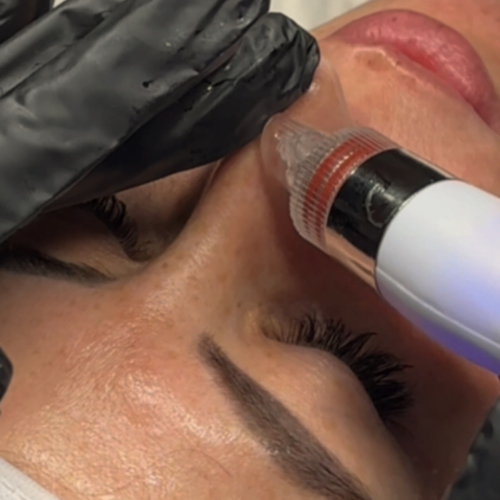 Fresh hydrated facial result
