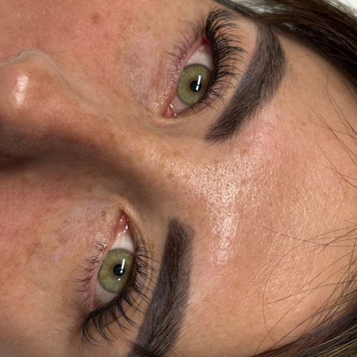 HydraGlow Facial result