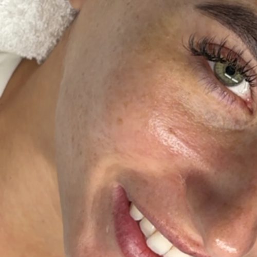 Smooth skin close-up after facial