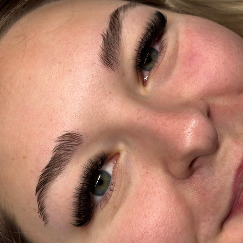 Fresh post-facial complexion at Destiny Aesthetics